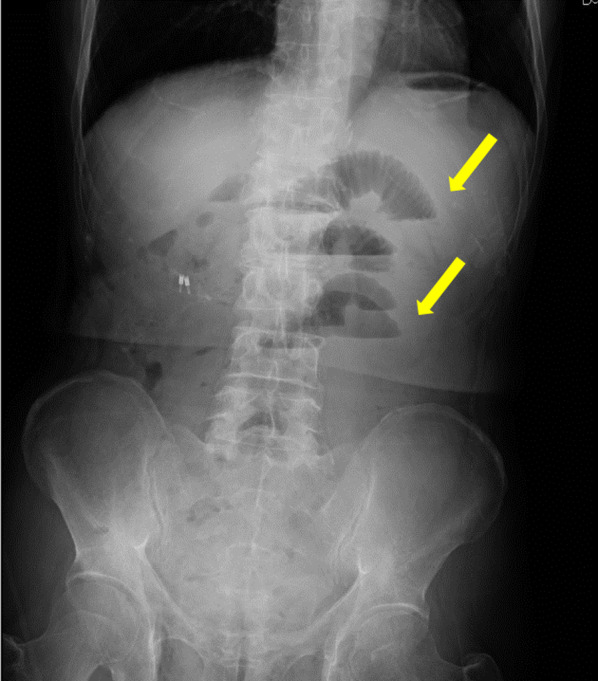 Fig. 2