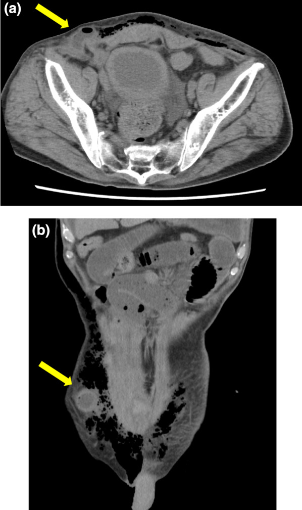 Fig. 3