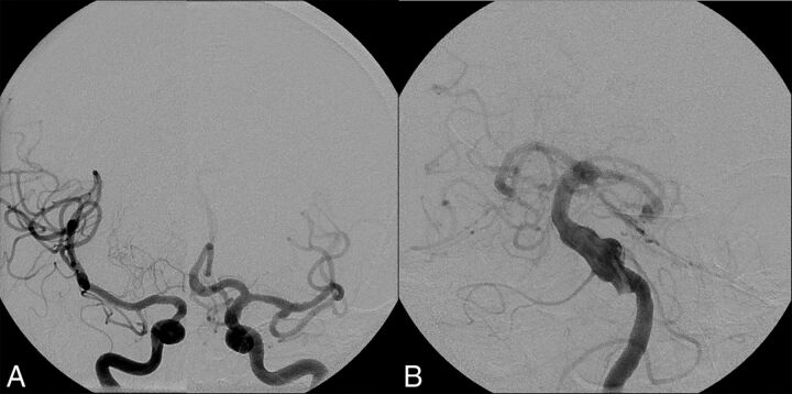 Fig 5.