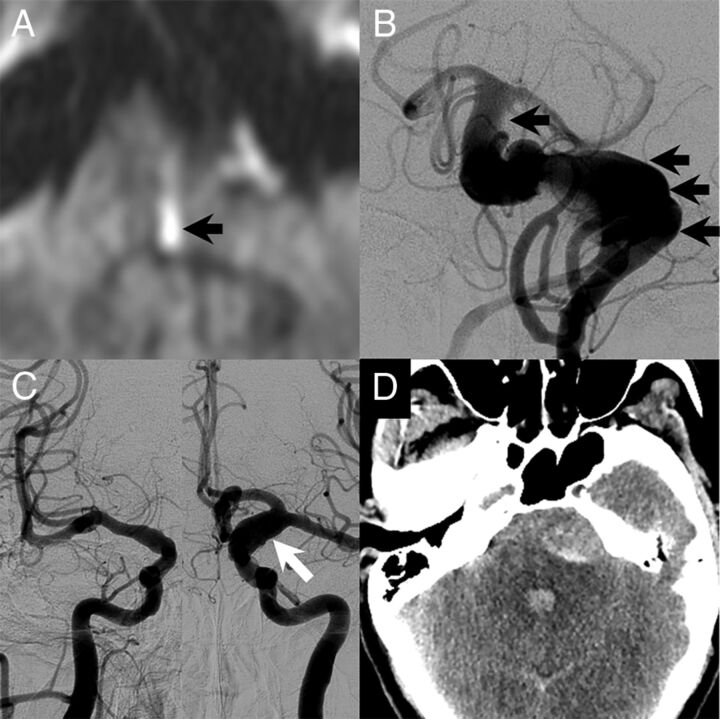 Fig 3.