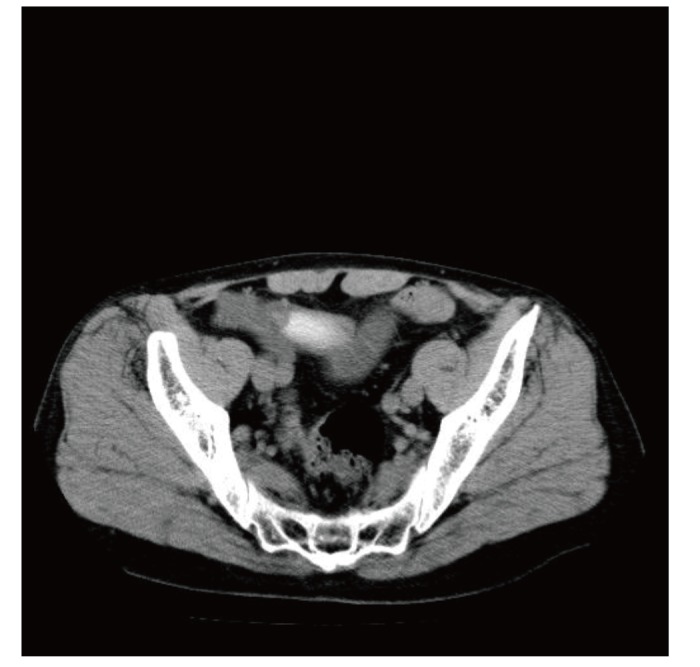 Fig. 2.