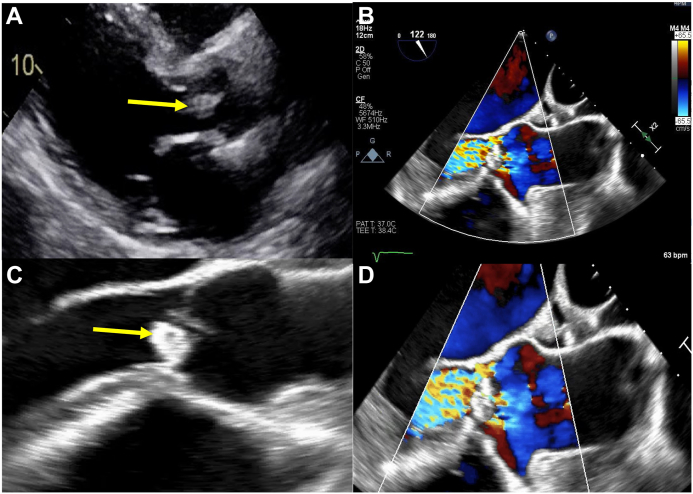 Figure 2