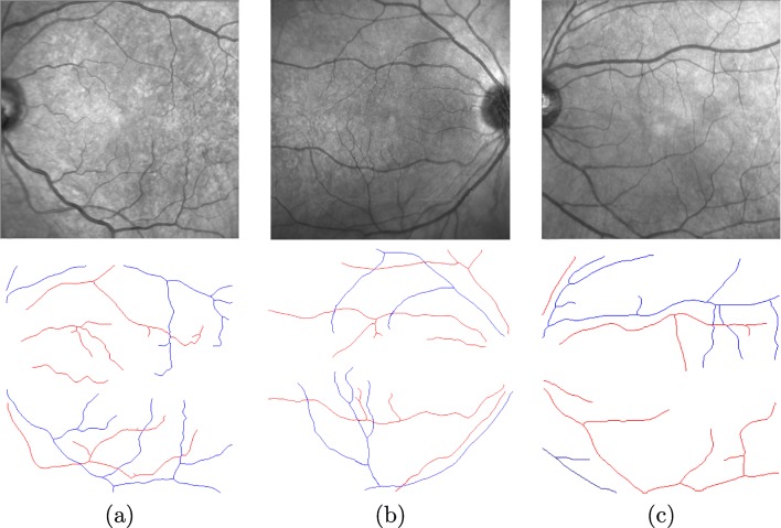 Fig. 11