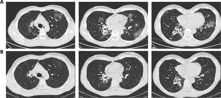 Fig. 2