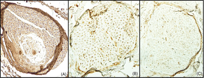 FIGURE 2