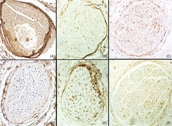 FIGURE 3