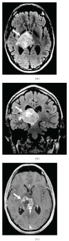Figure 17