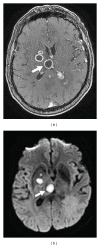Figure 21