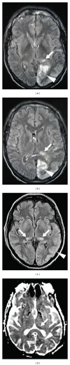 Figure 25