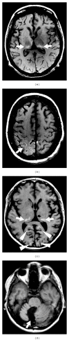 Figure 24