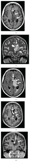 Figure 19