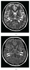 Figure 20