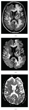 Figure 22