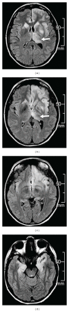 Figure 18