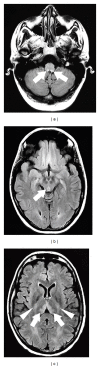 Figure 11