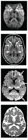 Figure 23