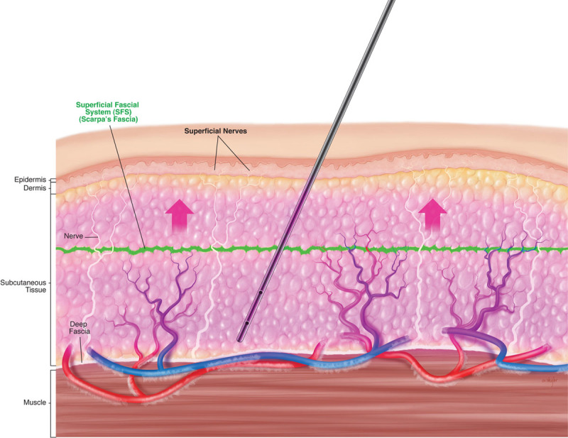 Fig. 10.