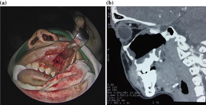 Fig. 1