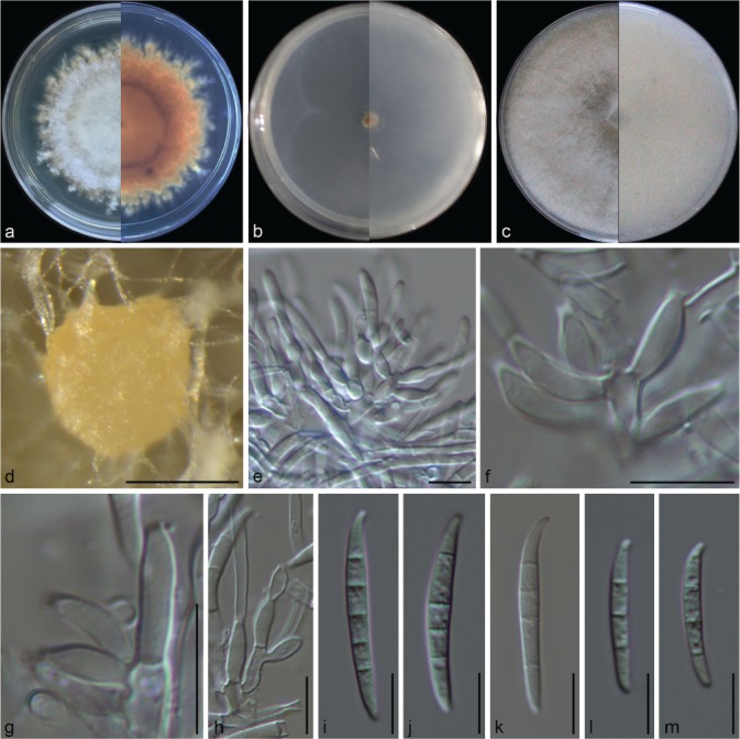 Fusarium incarnatum-equiseti complex from China - PMC