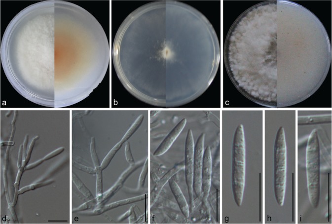 Fusarium incarnatum-equiseti complex from China - PMC