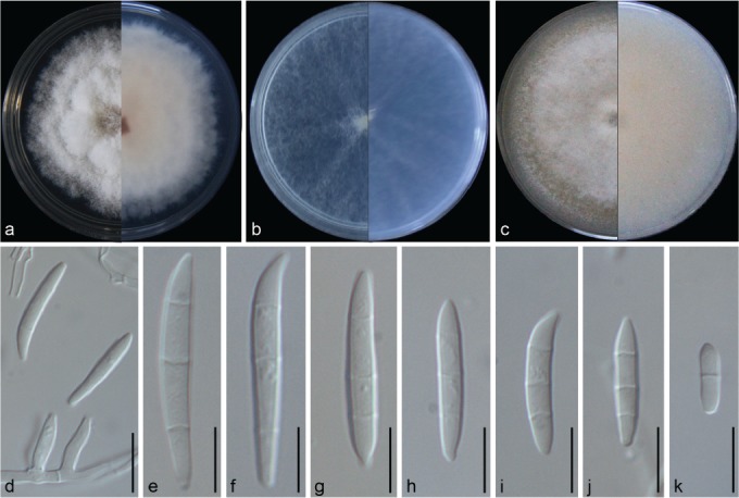 Fusarium incarnatum-equiseti complex from China - PMC