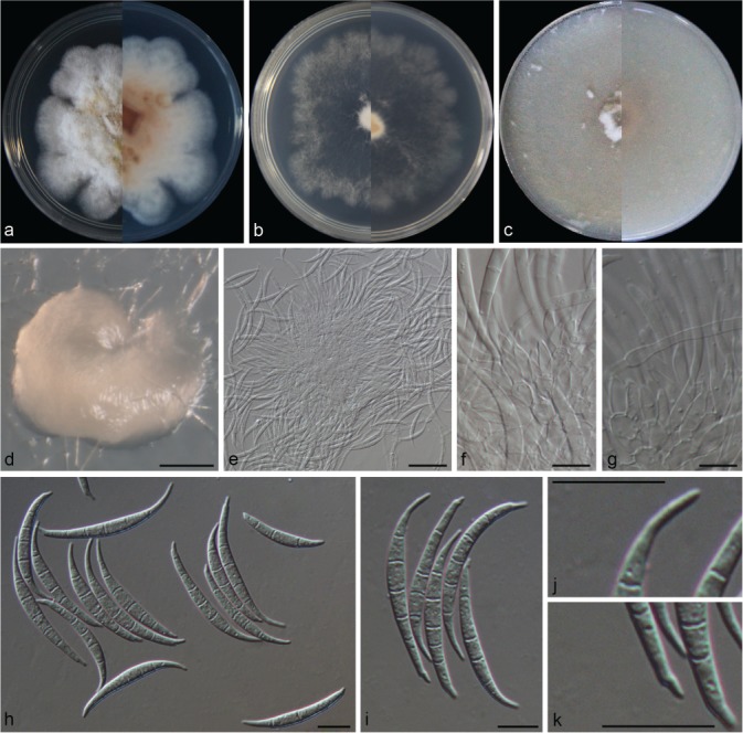 Fusarium incarnatum-equiseti complex from China - PMC