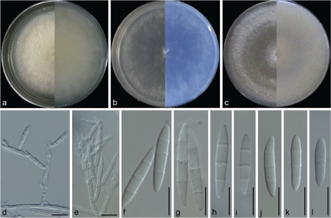 Fusarium incarnatum-equiseti complex from China - PMC