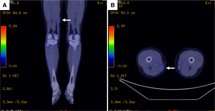 Fig. 6