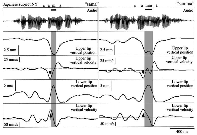 FIG. 1