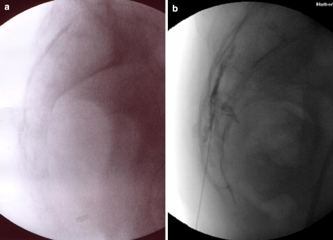 Fig. 4