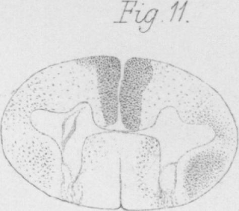 Fig. 11