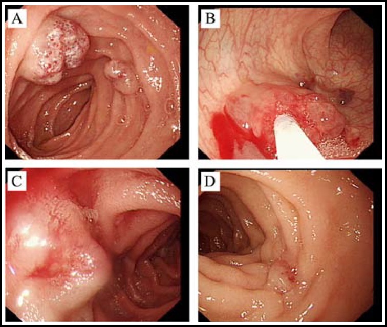 Fig.2