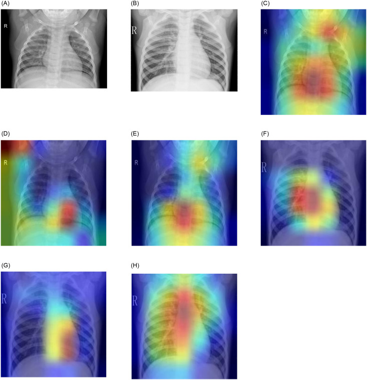 Fig 14