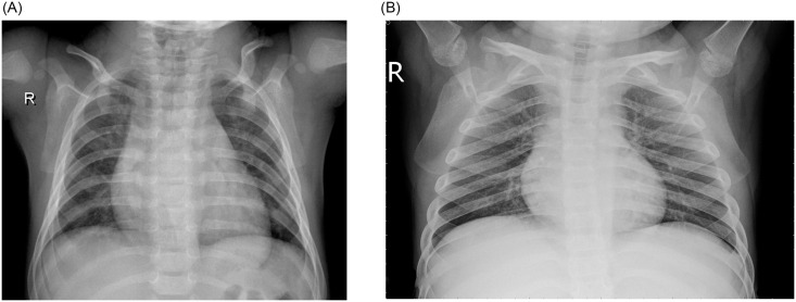 Fig 13