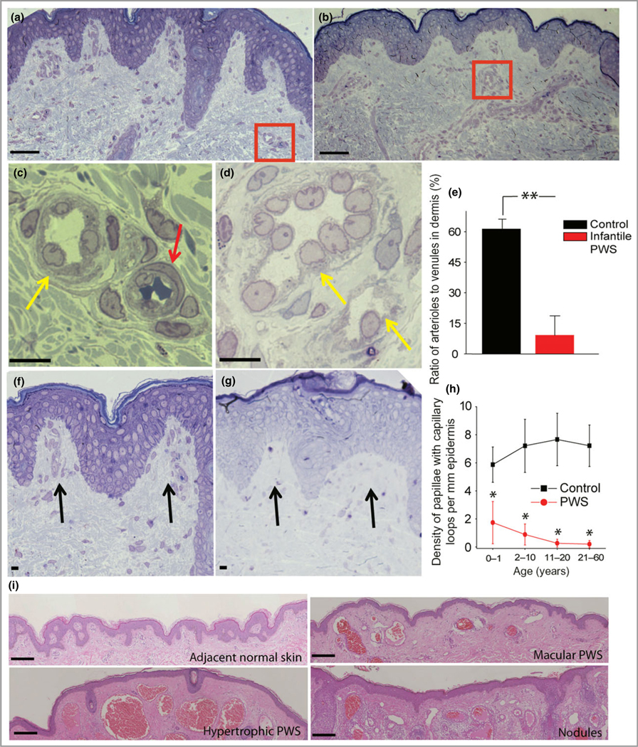 Fig 2.