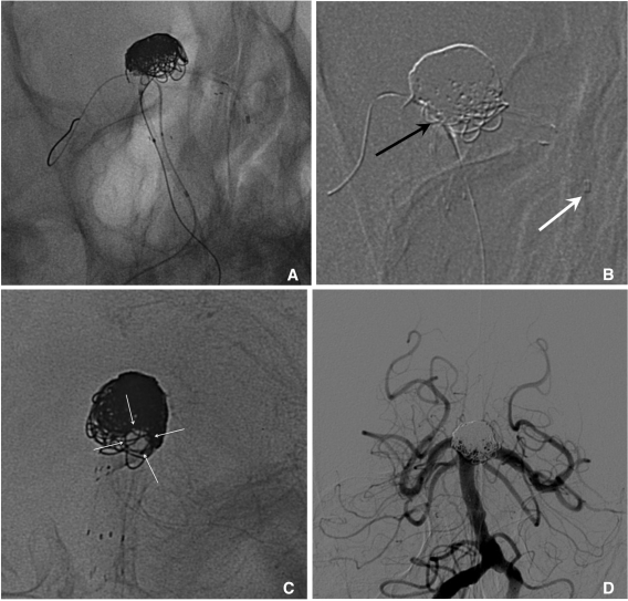 Fig. 10