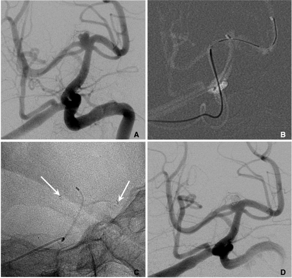 Fig. 11