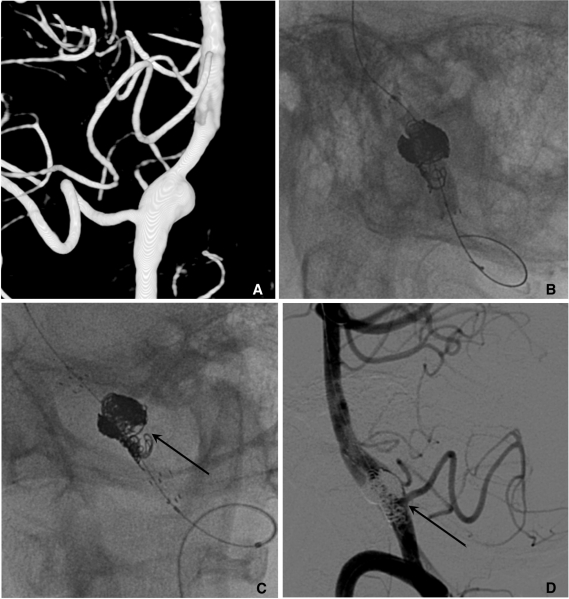 Fig. 15