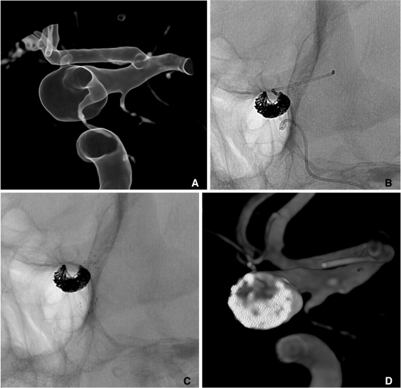 Fig. 16