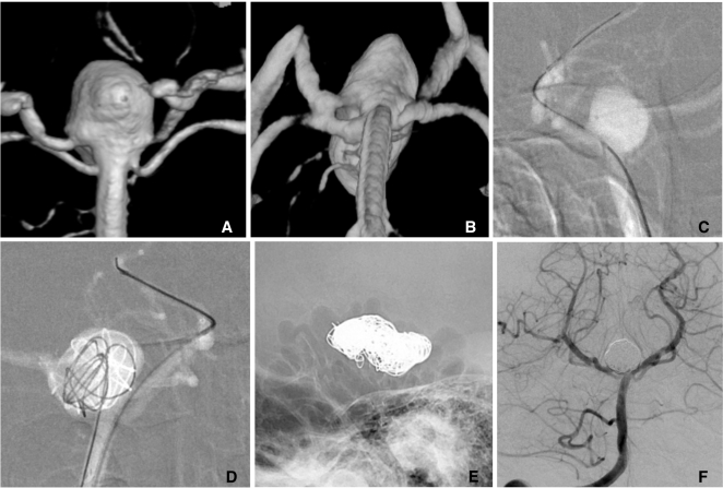 Fig. 12