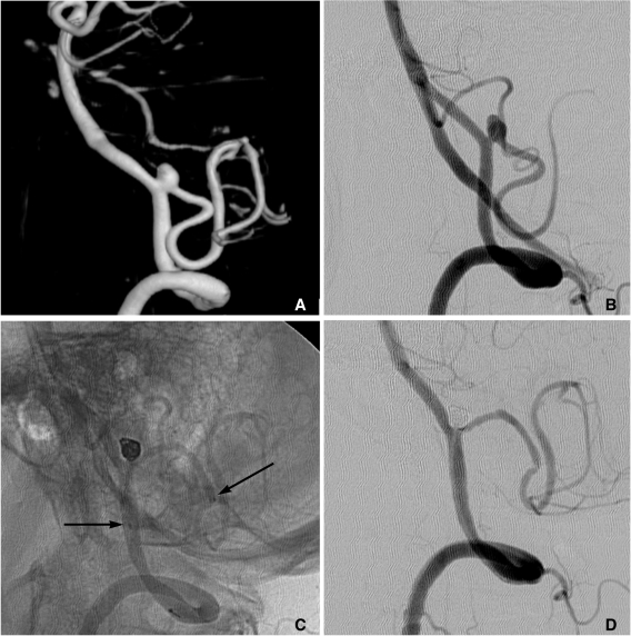 Fig. 18