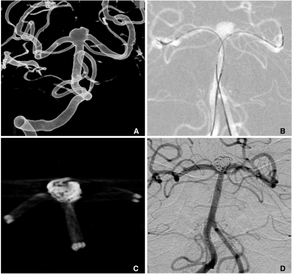 Fig. 13