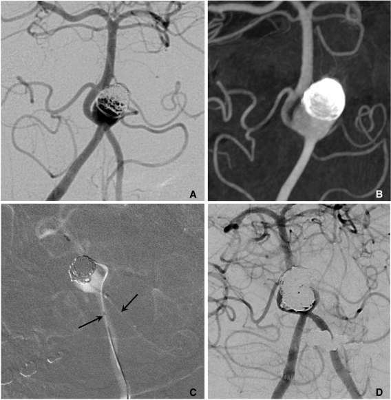 Fig. 14