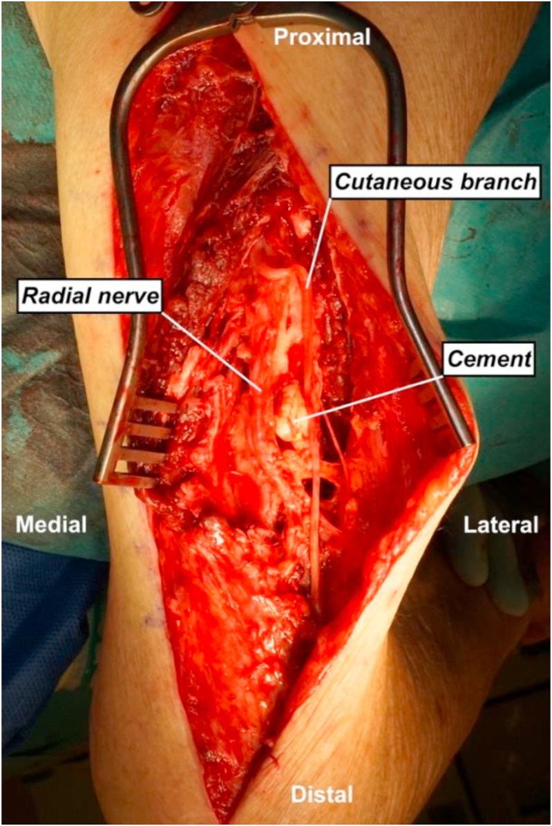 Fig. 2A