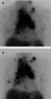 Fig. 3A,B
