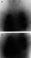 Fig. 1A,B