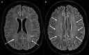 Fig. 10