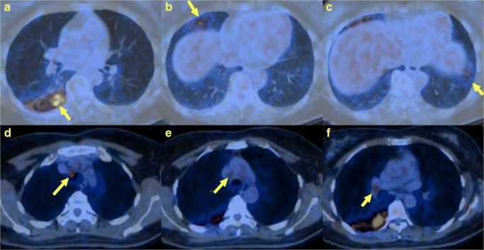 Fig. 5