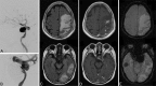 FIG 2.