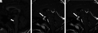 Figure 14.